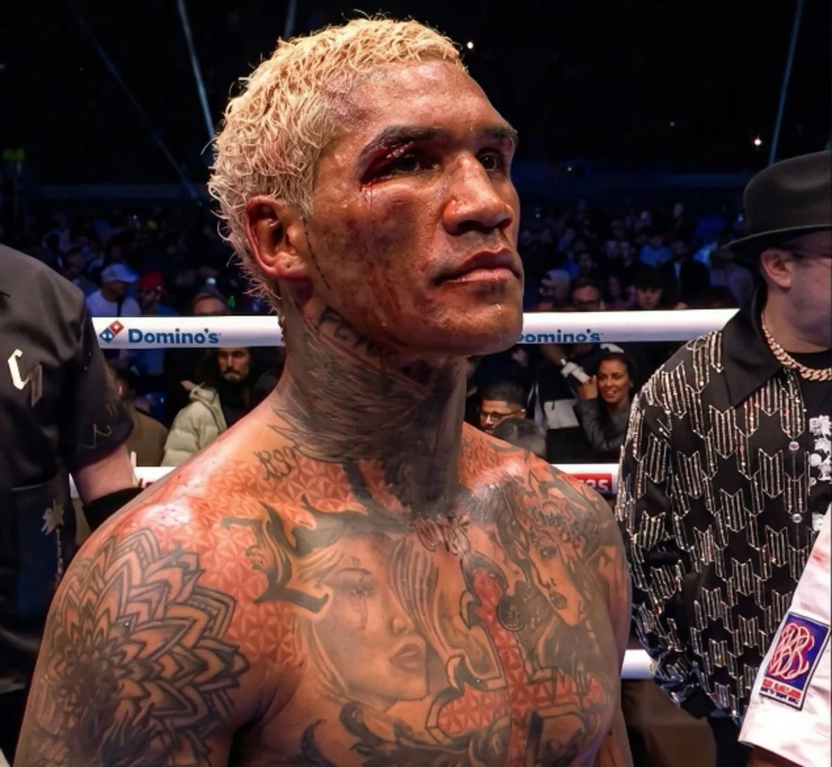 The Curious Case of Conor Benn’s Post-Fight Silence: A Broadcast Puzzle and a Fighter’s Precarious Position
